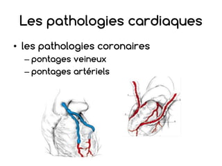 Les pathologies cardiaques
• les pathologies coronaires
– pontages veineux
– pontages artériels
Les pathologies cardiaques
• les pathologies coronaires
– pontages veineux
– pontages artériels
Les pathologies cardiaques
• les pathologies coronaires
– pontages veineux
– pontages artériels
Les pathologies cardiaques
• les pathologies coronaires
– pontages veineux
– pontages artériels
 