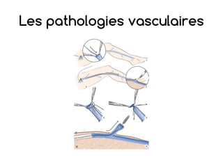 Les pathologies vasculaires
 
