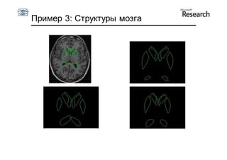Пример 3: Структуры мозга
 