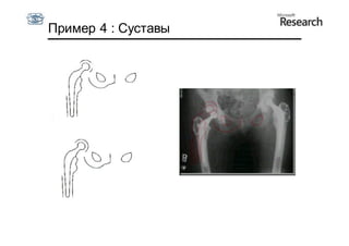 Пример 4 : Суставы

    x  x  p1b1




 3 1  b1  3 1
 
