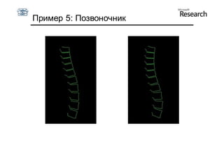 Пример 5: Позвоночник
 