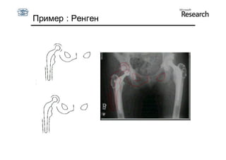 Пример : Ренген


    x  x  p1b1




 3 1  b1  3 1
 