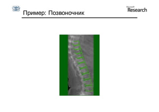 Пример: Позвоночник
 