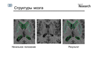 Структуры мозга




Начальное положение   Результат
 