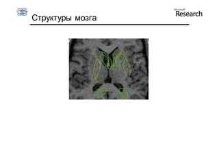 Структуры мозга
 