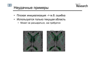 Неудачные примеры

• Плохая инициализация -> м.б. ошибка
• Используется только текущая область
  • Может не расшириться, как требуется
 