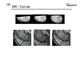 MR - Сустав
 