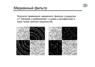 Медианный фильтр
Результат применения медианного фильтра с радиусом
в 7 пикселей к изображению с шумом и артефактами в
виде тонких светлых окружностей.
 