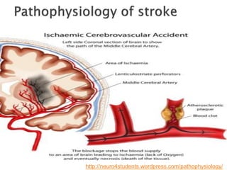 http://neuro4students.wordpress.com/pathophysiology/
 