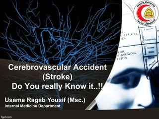 Cerebrovascular Accident
(Stroke)
Do You really Know it..!!
Usama Ragab Yousif (Msc.)
Internal Medicine Department
 
