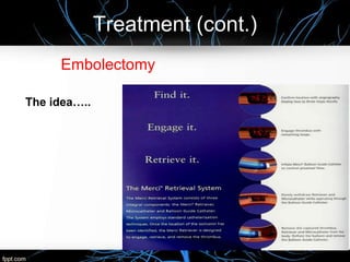 Treatment (cont.)
Embolectomy
The idea…..
 