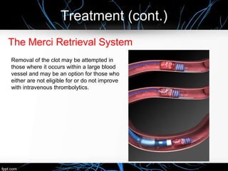 Treatment (cont.)
The Merci Retrieval System
Removal of the clot may be attempted in
those where it occurs within a large blood
vessel and may be an option for those who
either are not eligible for or do not improve
with intravenous thrombolytics.
 