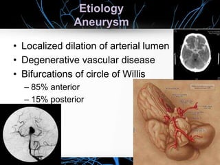 Etiology
Aneurysm
• Localized dilation of arterial lumen
• Degenerative vascular disease
• Bifurcations of circle of Willis
– 85% anterior
– 15% posterior
 