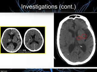 Investigations (cont.)
 