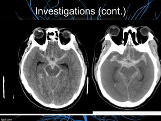 Investigations (cont.)
 