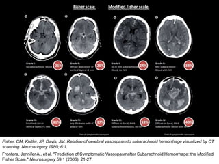 Fisher, CM, Kistler, JP, Davis, JM. Relation of cerebral vasospasm to subarachnoid hemorrhage visualized by CT
scanning. Neurosurgery 1980; 6:1.
Frontera, Jennifer A., et al. "Prediction of Symptomatic Vasospasmafter Subarachnoid Hemorrhage: the Modified
Fisher Scale." Neurosurgery 59.1 (2006): 21-27.
 