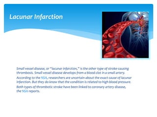 Small vessel disease, or “lacunar infarction,” is the other type of stroke-causing
thrombosis. Small vessel disease develops from a blood clot in a small artery.
According to the NSA, researchers are uncertain about the exact cause of lacunar
infarction. But they do know that the condition is related to high blood pressure.
Both types of thrombotic stroke have been linked to coronary artery disease,
the NSA reports.
Lacunar Infarction
 