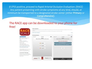 The RACE app can be downloaded to your phone for
free!
If CPSS positive, proceed to Rapid Arterial Occlusion Evaluation: (RACE)
Any patient presenting with stroke symptoms of any kind, should, at
minimum be transported to a designated stroke center (either Primary or
Comprehensive).
 