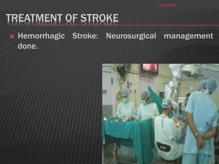 TREATMENT OF STROKE
 Hemorrhagic Stroke: Neurosurgical management
done.
11/28/2016
19
 