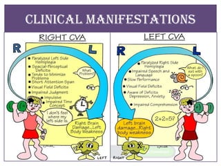 CLINICAL MANIFESTATIONS
 