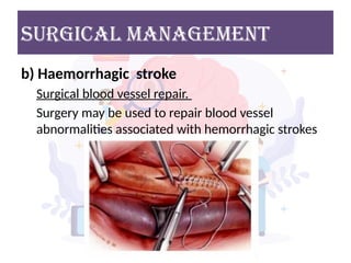 surgICAL MANAGEMENT
b) Haemorrhagic stroke
Surgical blood vessel repair.
Surgery may be used to repair blood vessel
abnormalities associated with hemorrhagic strokes
 