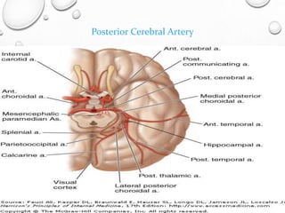 Posterior Cerebral Artery
 