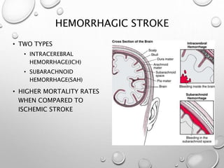 HEMORRHAGIC STROKE
• TWO TYPES
• INTRACEREBRAL
HEMORRHAGE(ICH)
• SUBARACHNOID
HEMORRHAGE(SAH)
• HIGHER MORTALITY RATES
WHEN COMPARED TO
ISCHEMIC STROKE
 