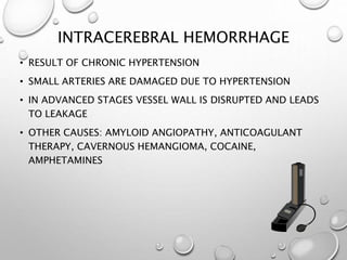 INTRACEREBRAL HEMORRHAGE
• RESULT OF CHRONIC HYPERTENSION
• SMALL ARTERIES ARE DAMAGED DUE TO HYPERTENSION
• IN ADVANCED STAGES VESSEL WALL IS DISRUPTED AND LEADS
TO LEAKAGE
• OTHER CAUSES: AMYLOID ANGIOPATHY, ANTICOAGULANT
THERAPY, CAVERNOUS HEMANGIOMA, COCAINE,
AMPHETAMINES
 
