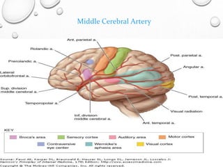 Middle Cerebral Artery
 