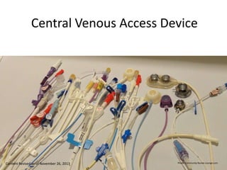Central Venous Access Device
Photo: Community Nurses Lounge.comContent Revised as of November 26, 2013
 