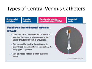 Types of Central Venous Catheters
Photo: Genentech Cath Matters USA
 