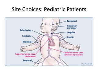 Site Choices: Pediatric Patients
 