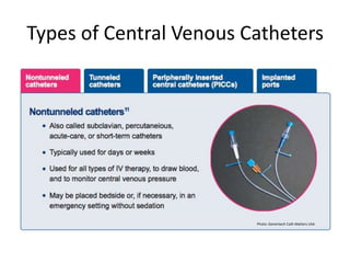 Types of Central Venous Catheters
Photo: Genentech Cath Matters USA
 