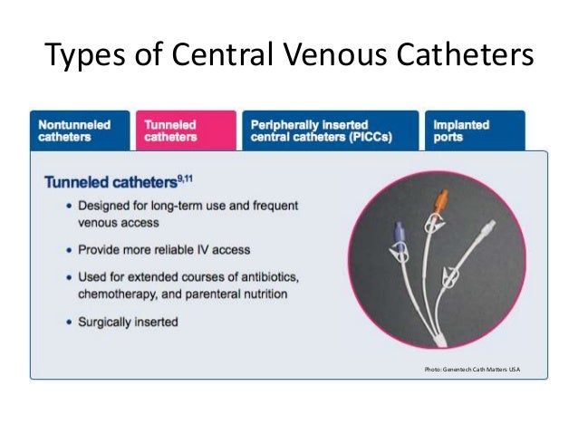 cvad venous catheters