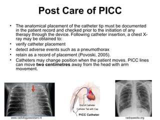 CVAD Management, Care and Maintenance (Radiology Nursing) | PPT