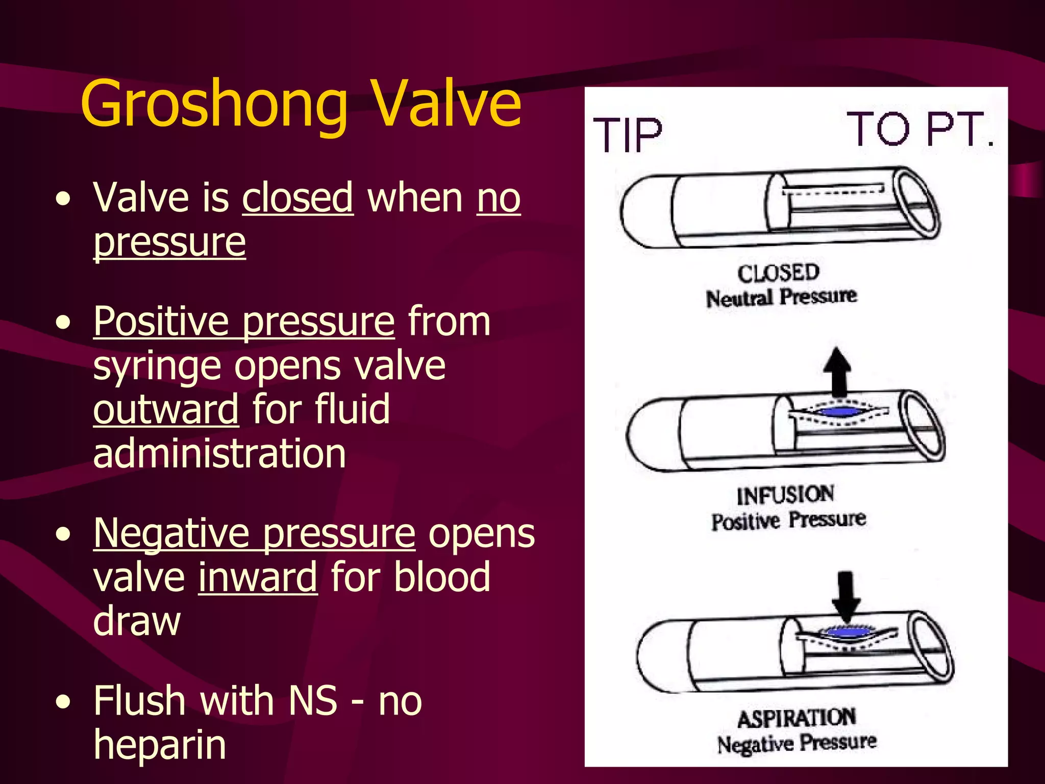 Groshong Valve Valve is  closed  when there is  no pressure Positive pressure  from syringe opens valve  outward  for fluid administration Negative pressure  opens valve  inward  for blood draw Flush with NS - not heparin 