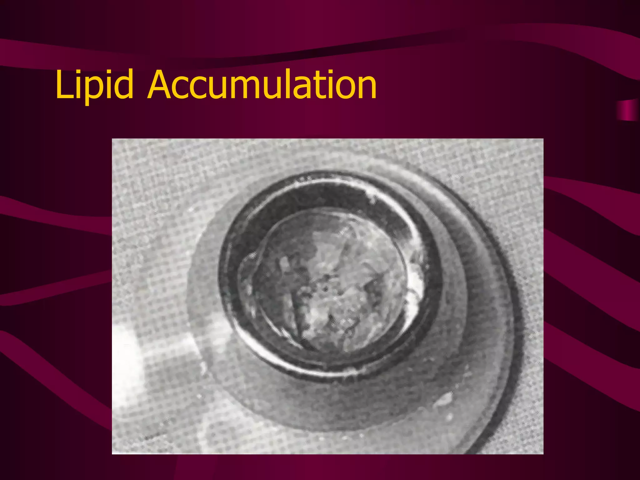 Intraluminal Clot Formation Clot inside the catheter Caused by inappropriate flushing or heparinization May be reversed with Alteplace or line may need to be removed or exchanged Do not use force to attempt to open line 