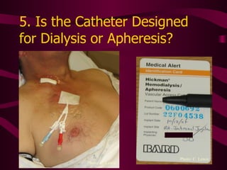 5. Is the Catheter Designed for Dialysis or Apheresis? Photo: C. Lewis Photo: C. Lewis Patients receive ID card at time of insertion. 