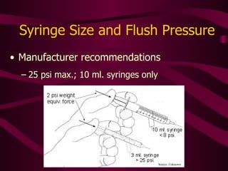 Flush Technique To clear blood in central lines Use intermittent positive pressure to create turbulence and thoroughly clear the line 20-30 ml. NS 2 ml – stop – 2 ml – stop – 2 ml – stop After flushing  any  peripheral, open-ended, or Groshong cannula Keep thumb on plunger and inject while withdrawing syringe This prevents an air void that permits blood to back up into the cannula and form clots 