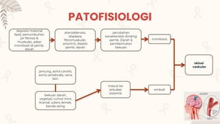 PATOFISIOLOGI
deposisi material
lipid, pertumbuhan
jar fibrosa &
muskular, adesi
trombosit di pemb.
darah
aterosklerosis,
displasia
fibromuskular,
arteritris, diseksi
pemb. darah
perubahan
karakteristik dinding
pemb. Darah &
pembentukan
bekuan
trombosis
bekuan darah,
vegetasi, tumor intra
kranial, udara, lemak,
benda asing
jantung, aorta carotis,
aorta vertebralis, vena
lain
masuk ke
sirkulasi
sistemik
emboli
oklusi
vaskular
 
