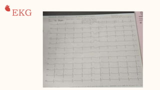 EKG
0
2
 