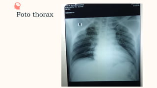Foto thorax
0
2
 