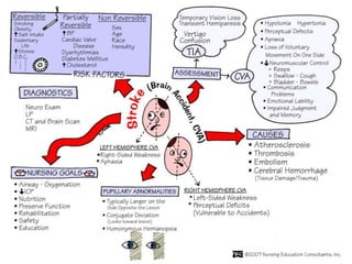 CVA and its causes and sign , symptoms treatment | PPTX