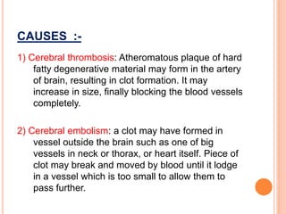 Cerebro vascular accident | PPTX