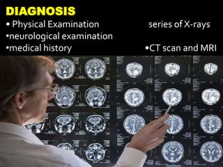 DIAGNOSIS
• Physical Examination series of X-rays
•neurological examination
•medical history •CT scan and MRI
 