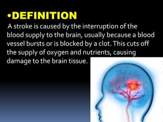•DEFINITION
A stroke is caused by the interruption of the
blood supply to the brain, usually because a blood
vessel bursts or is blocked by a clot.This cuts off
the supply of oxygen and nutrients, causing
damage to the brain tissue.
 