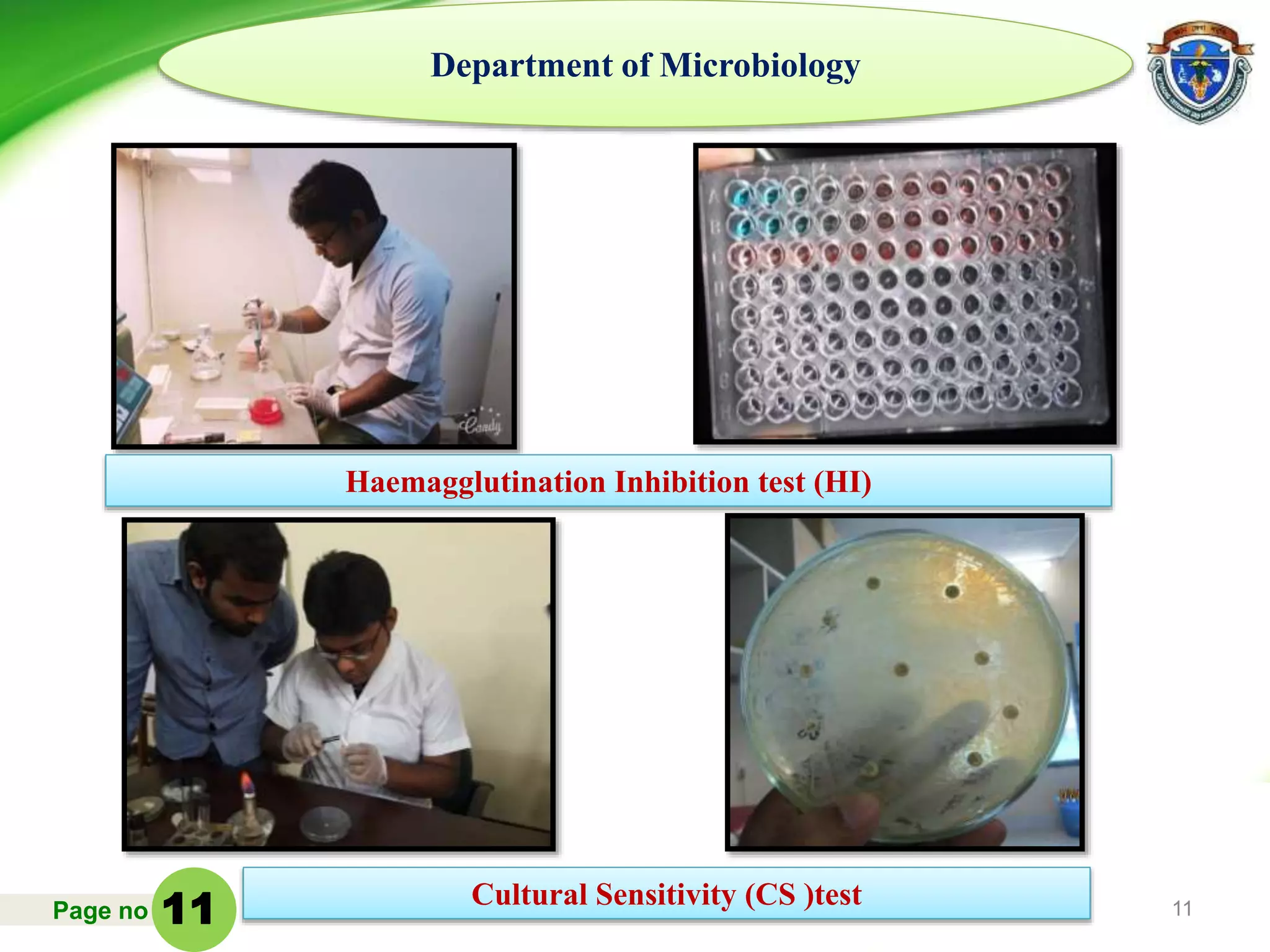 Page no 11
Department of Microbiology
Haemagglutination Inhibition test (HI)
Cultural Sensitivity (CS )test
11
 