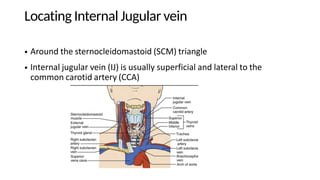 cvc-placement.pdfmedical power point presentation | PDF