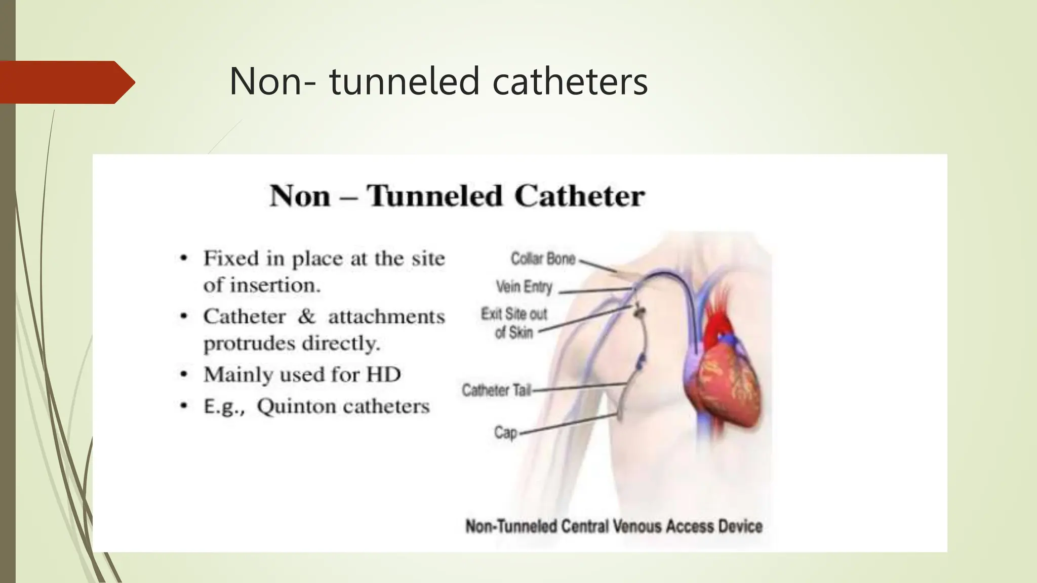 Central Line Indication Algorithm Central Venous Catheter Care - Central Line Associated Blood Stream ...