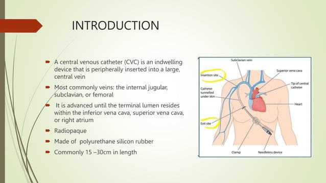 Central Venous Catheter Care - Central Line Associated Blood Stream ...